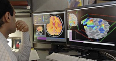 Exames cerebrais